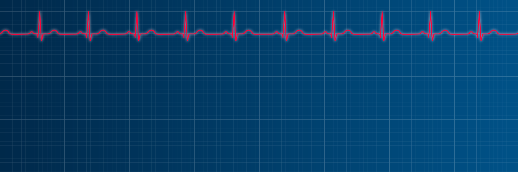 an illustration of an EKG